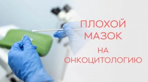 🧫 Что делать, если мазок на онкоцитологию плохой?