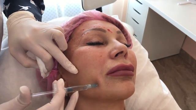 Коррекция деформационного типа с помощью препарата TWAC Eyes