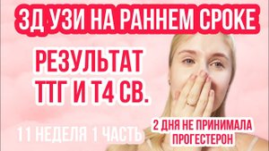 3Д УЗИ на раннем сроке ◈ СЕРДЦЕБИЕНИЕ ◈ТТГ и Т4◈11 неделя беременности 1Часть◈Влоги беременной Сашки