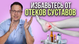 ВЫЛЕЧИТЕ ВАШИ СУСТАВЫ! Разбор отеков, синовиальный отек с Георгием Темичевым