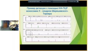 QF-ПЦР для пренатальной диагностики анеуплоидий