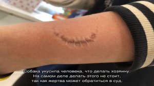 Если собака укусила человека, что грозит хозяину? Что хозяину делать с укусившей человека собакой?