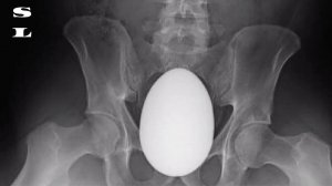 Рентгеновские снимки, которые врачи запомнят надолго!