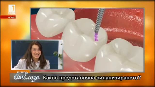 Национална кампания за безплатно поставяне на силанти смотреть онлайн