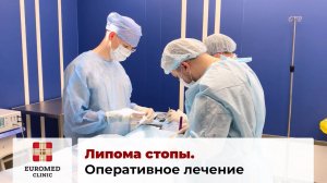 Липома стопы. Удаление и лечение липомы стопы. Как удаляют липому