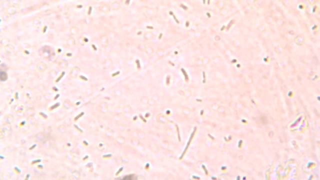 Escherichia coli (no stain) смотреть онлайн