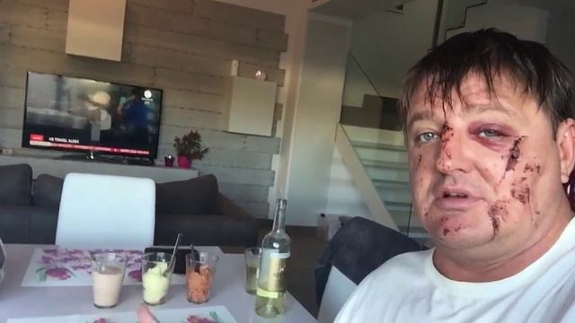 что кушают, после падения с велосипеда смотреть онлайн