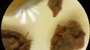 Процесс заваривания чая под микроскопом