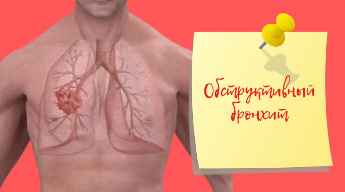 Обструктивный бронхит | Лучший способ борьбы с бронхитом.