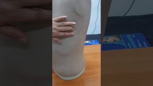 Определение симптома Аркавина