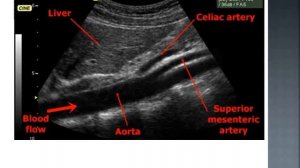 ABDOMINAL ULTRASOUND