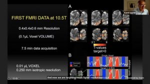 Big Data Neuroscience Workshop 2021 (ACNN)