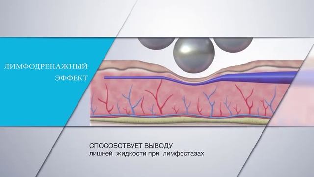 Аппарат Эндосфера представлен в Clinic&spa Zолотой.