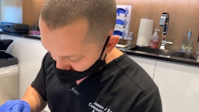 TCA CROSS for ICE-PICK, PITTED, & ROLLING BOXCAR SCARS | ACNE SCAR TREATMENT PART 1 | Dr. Jason Eme смотреть онлайн