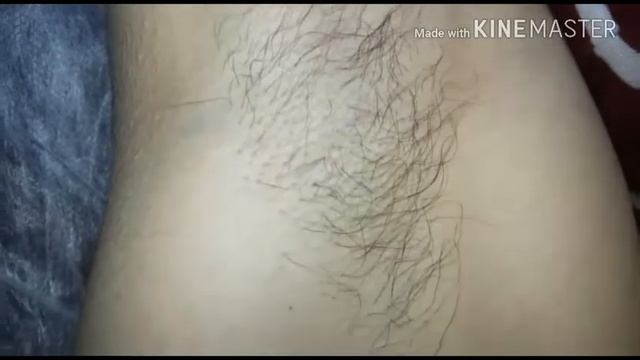 Шугаринг. До и После. смотреть онлайн