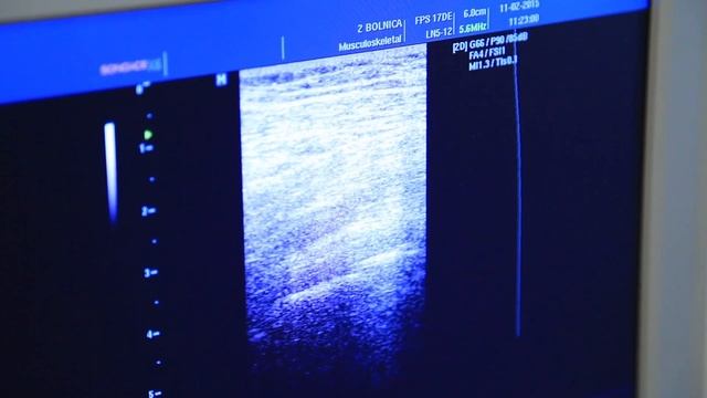 2 Городская клиническая больница - Внутрисуставное введение смотреть онлайн