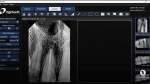 Tutorial - The Complete Guide To NanoPix X-Ray Sensor Software By Dr.Mohamed Tawakol - TDS, Egypt