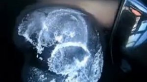 Ремонт вмятины на кузове автомобиля за 3 минуты