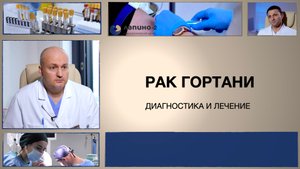 Рак гортани. Лечение и диагностика в онкоцентре Лапино-2.
