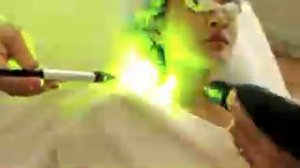 QuadroStar Pro Yellow (laser-ms.ru) -желтый лазер для удаления купероза, розации, винных пятен.