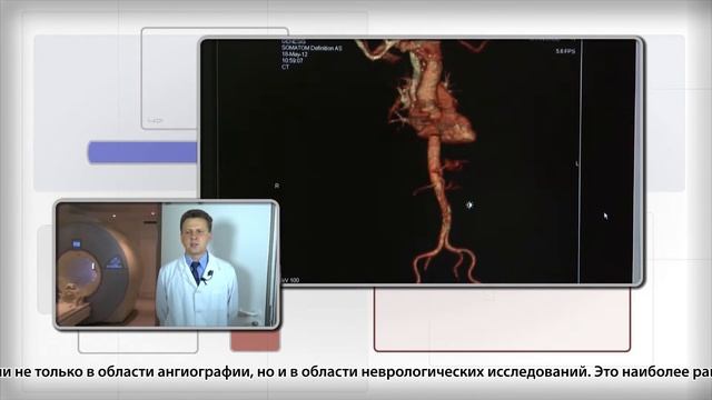 Компьютерная томография 3