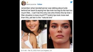 wtf happened to kendall jenner's face...?!