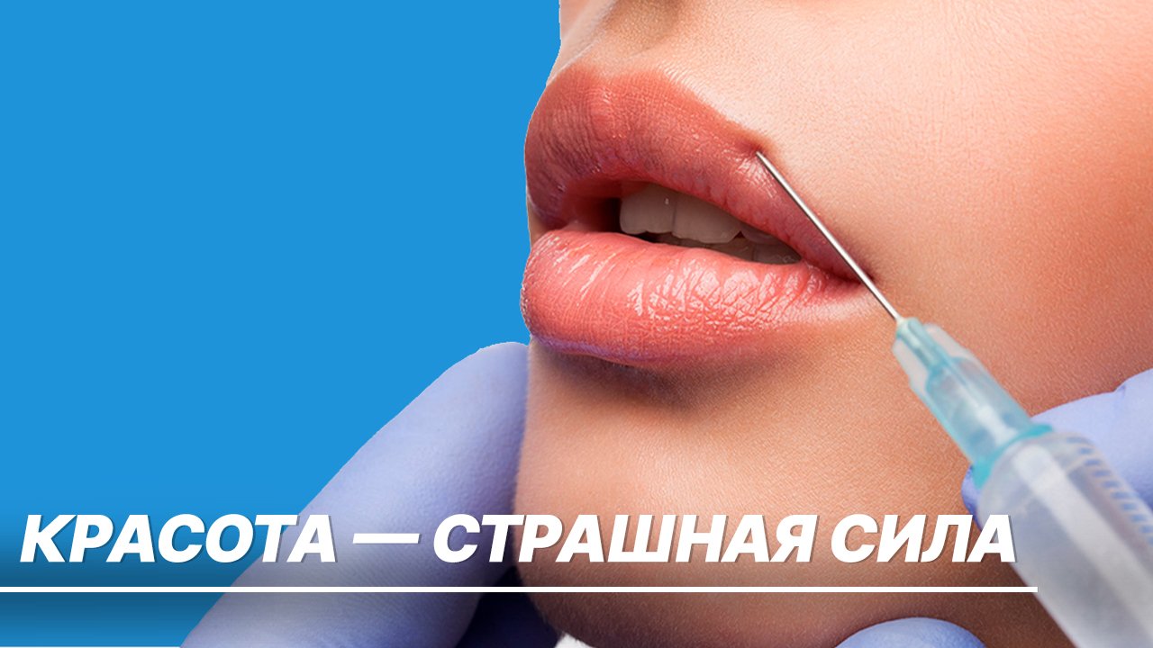 Жертвы увеличения губ. Чем опасны инъекции дешевыми филлерами из интернет-магазинов?