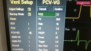 PCV VG | Pressure Control Ventilation - Volume Guarantee | Ventilation Mode