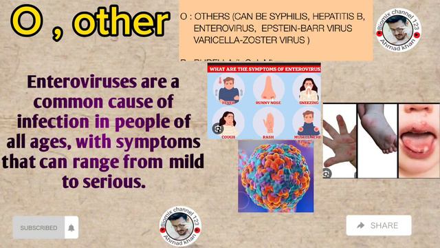 Torch profile/ T- Toxoplasma/o _ other/ r _ rubella virus/ c - cytomegalovirus/h _ herpes in Pashto смотреть онлайн