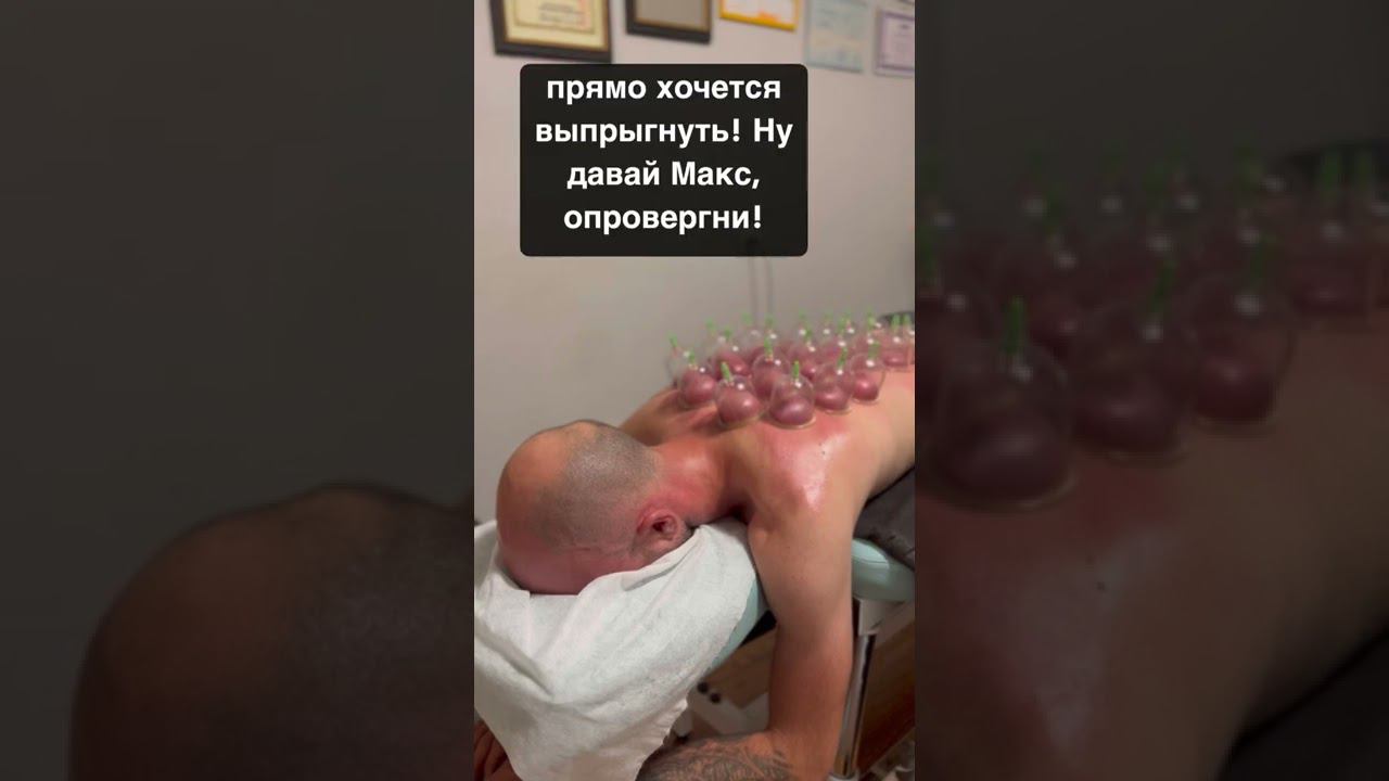 Какие ощущения когда делают баночный массаж! Вакуумная терапия!