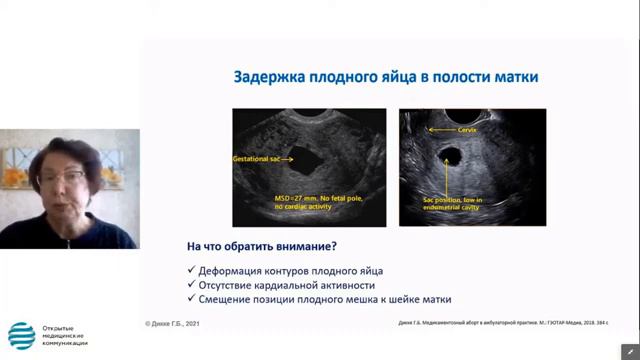 Вебинар 16.04. Диагностические критерии УЗИ при проведении медикаментозного аборта Дикке Г.Б. смотреть онлайн