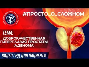 #ПРОСТО_о_СЛОЖНОМ Доброкачественная гиперплазия простаты (аденома).