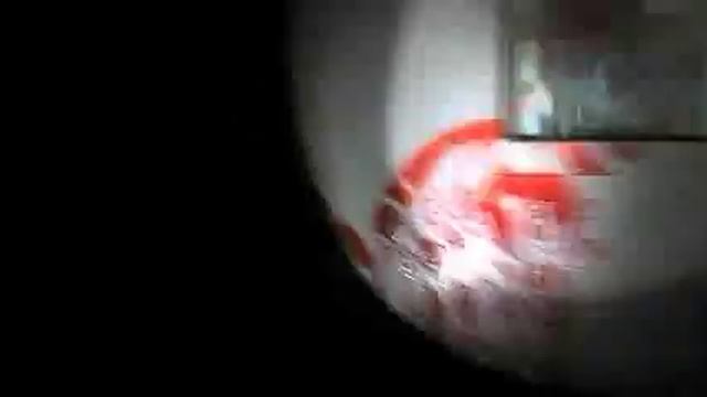 Dementium: The Ward - DS Trailer смотреть онлайн