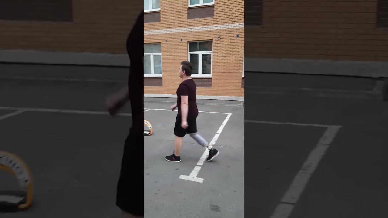 Протез голени модульный. 6-ть дней на протезе.