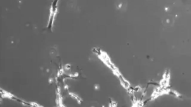 Замедленная съёмка нейронов, формирующих новые связи. Примерно так выглядят ваши мысли смотреть онлайн