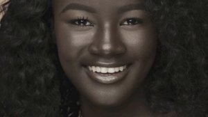 5 УНИКАЛЬНЫХ  ДЕВУШЕК С НЕОБЫЧНЫМ ЦВЕТОМ КОЖИ