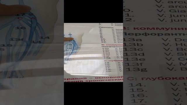 Лечение вены без операции. Патологическая вена Джиакомини. Флеболог Москва