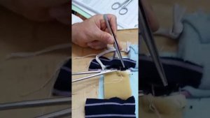 Пластика по бассини