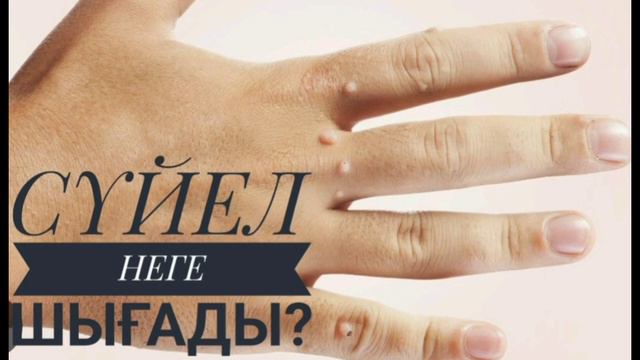 СҮЙЕЛ НЕДЕН ШЫҒАДЫ? ЕМДЕУ ЖОЛДАРЫ