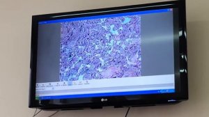 Гистология. Плацента материнская часть