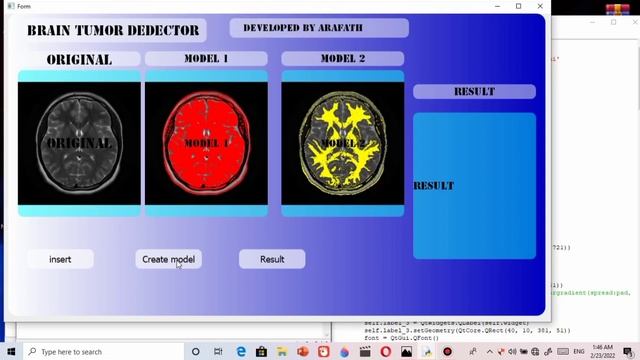 brain tumor detection with python machine learning & computer vision смотреть онлайн