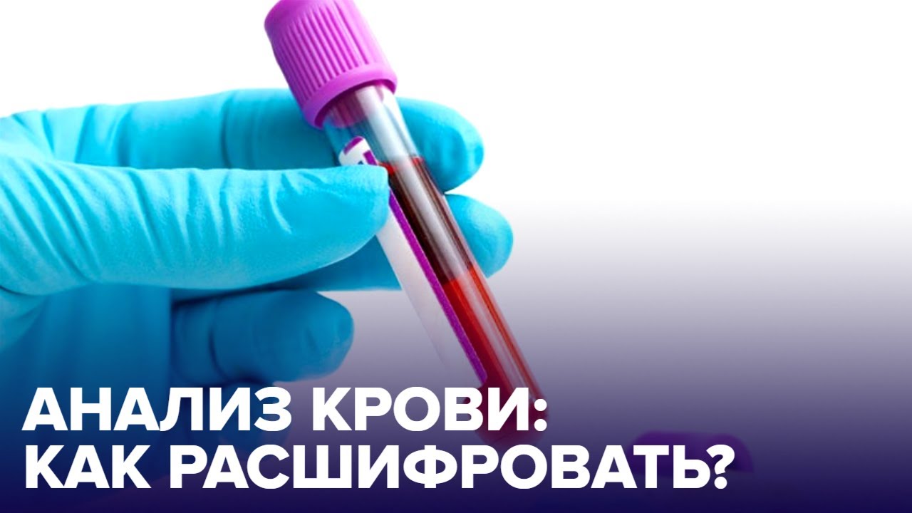 Как СДАВАТЬ и как расшифровать общий АНАЛИЗ КРОВИ?