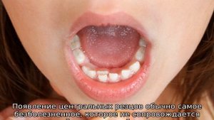 Какие зубы лезут первыми у ребенка — схема