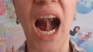 Упражнение лошадка.  Артикуляционная гимнастика. Занятие с логопедом