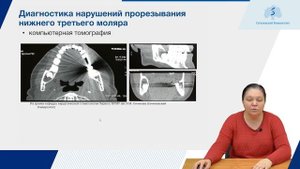Болезни прорезывания зубов. Часть 1