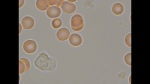 Гранулоцит нейтрофильный малоподвижный, палочковидная бактерия под микроскопом Микмед 6 в 7