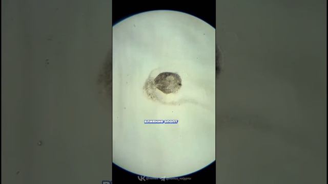 Экстрагенитальные заболевания влияют на фертильность женщин? 🧬 #Изнутри_ВолгГМУ смотреть онлайн