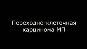 взвесь в мочевом пузыре, новообразования мочевого пузыря
