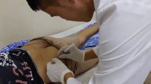 укол в ягодицу взрослым. внутримышечный укол техника