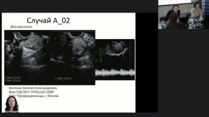 Новая классификация ORADS - новость или событие. Профессор Гажонова В.Е.
